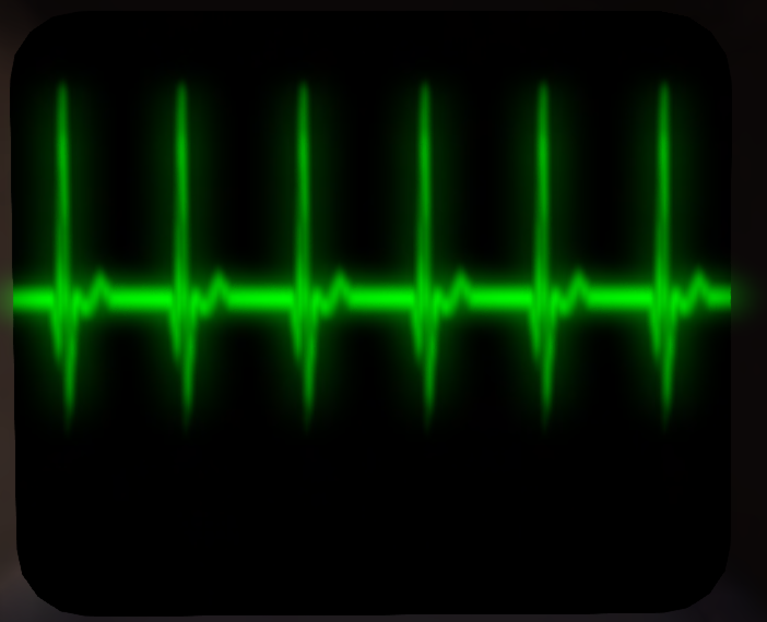 Ekg-normal.png