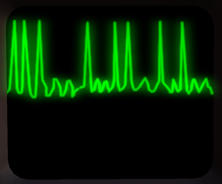 Ekg-afib.png